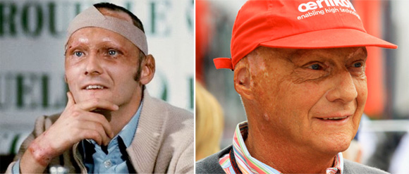 NikiLauda_ThenandNow